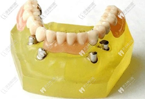 長期戴用過渡性義齒是會引起牙齦萎縮的