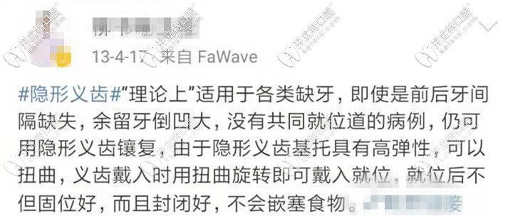 活動(dòng)隱形義齒的優(yōu)勢