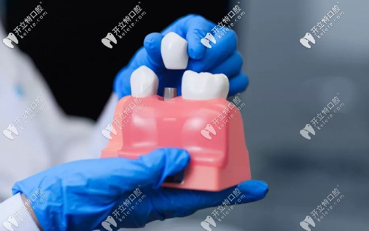 根管治療后為什么要戴牙冠 根管治療后為什么要戴牙冠