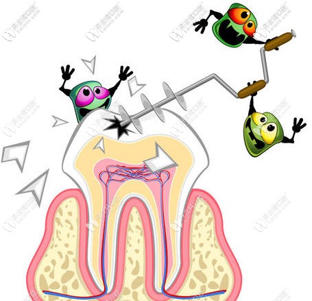 根管治療了一半該如何？