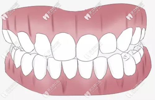 牙周整形術(shù)是什么