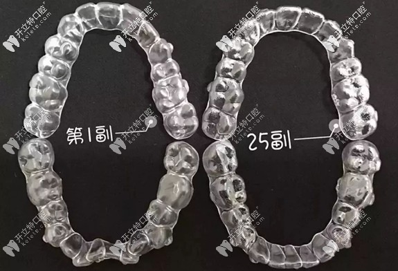 戴隱形牙套1副和25副的效果區(qū)別