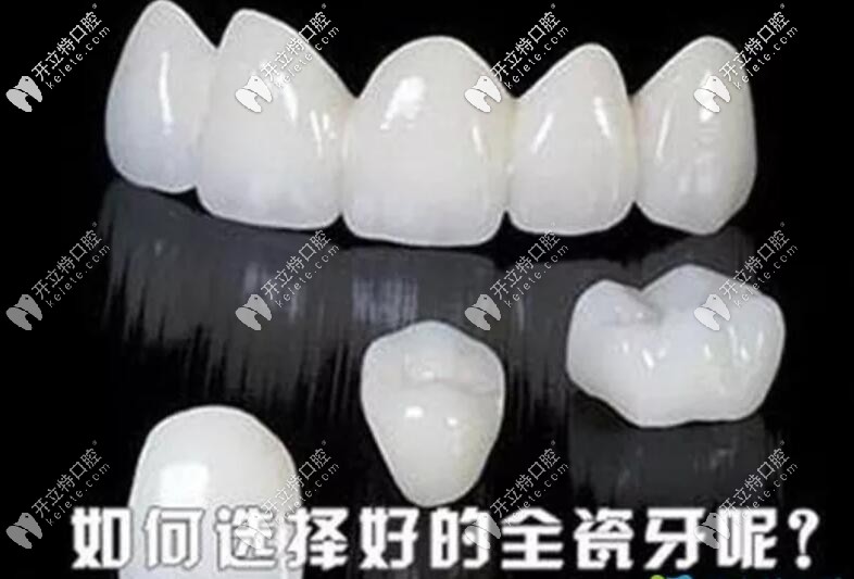 全瓷牙如何選擇