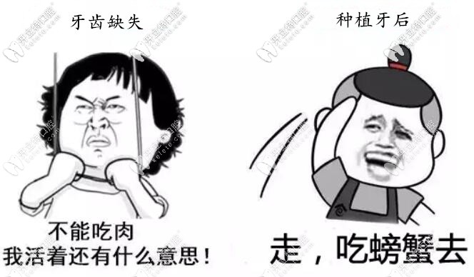 種植牙要使用一輩子,必須避開這4個坑選擇適合的種植體！