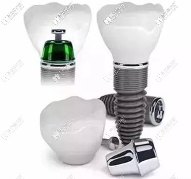 種牙選好植體是關(guān)鍵，醫(yī)生技術(shù)更關(guān)鍵