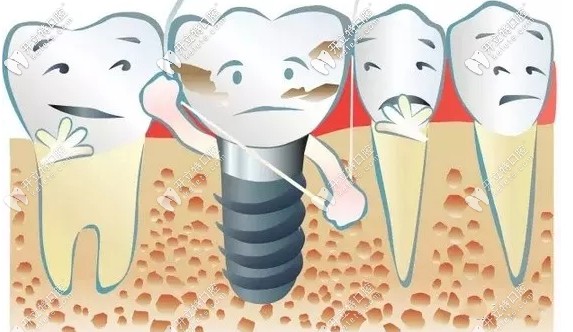 韓國(guó)種植牙和瑞士種植牙的根本區(qū)別不僅是價(jià)格懸殊這點(diǎn)吧