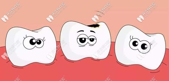 吉爾巴赫全瓷牙的價格是怎么樣的