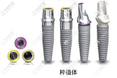 科普不同年齡的人做種牙時,該怎么選擇種植體品牌？