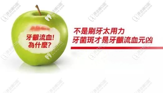 牙菌斑導(dǎo)致牙齦出血