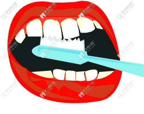 軟毛牙刷進(jìn)行刷牙