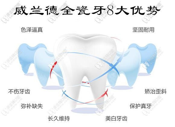 進口威蘭德全瓷牙8大優(yōu)勢