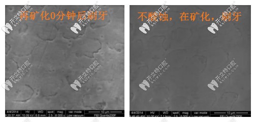 電子顯微鏡觀察再礦化