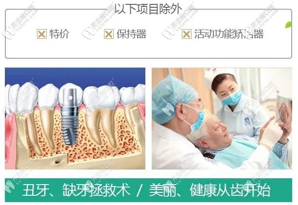 圣貝牙科種植牙和矯正活動(dòng)