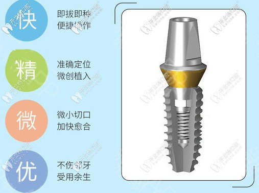 韓國登特斯種植體