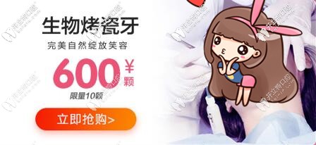 生物烤瓷牙價(jià)格 蘭州皓亞齒科