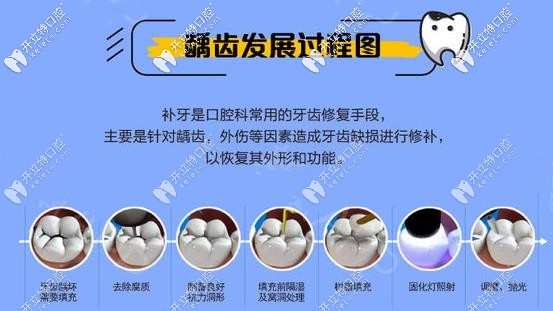 補(bǔ)牙的過程