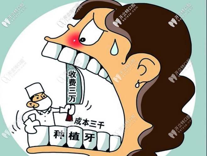 種牙貴是材料及醫(yī)生技術(shù)