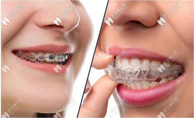 廣州瑞德口腔正畸特別活動