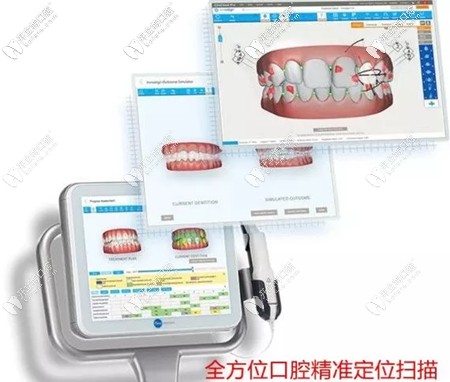 在藝星口腔戴隱形牙套矯正還有優(yōu)惠可享 在藝星口腔戴隱形牙套矯正還有優(yōu)惠可享