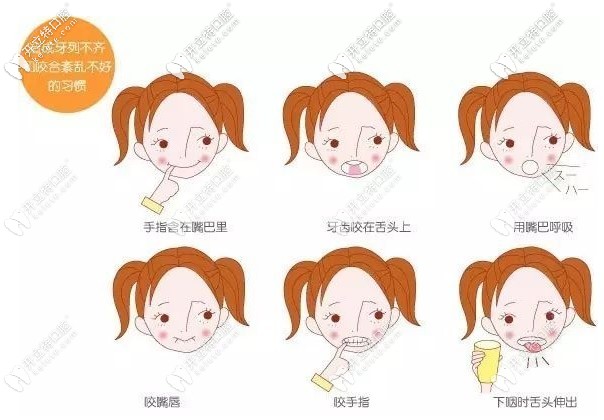 任蕾醫(yī)生比較擅于各類兒牙的矯正