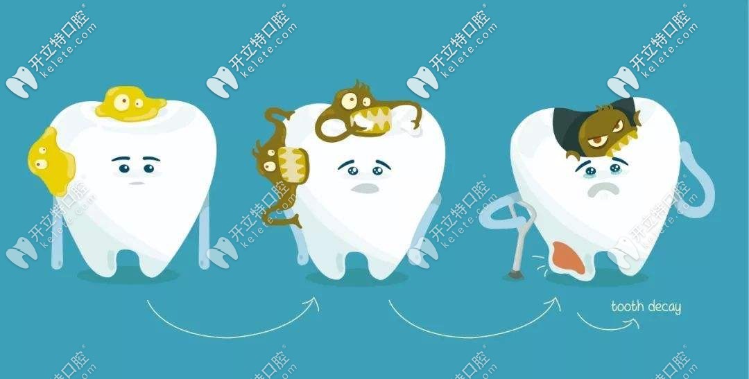 別不信,兒童牙齒齲壞到重度就要做根管治療啦！