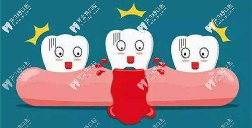 牙齦出血等情況不適合進行牙齦按摩