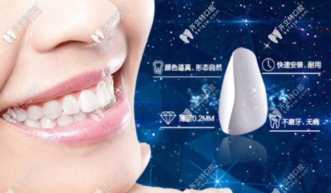 南京藝星口腔牙齒瓷貼面 南京藝星口腔牙齒瓷貼面