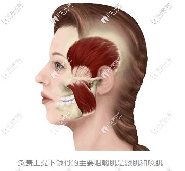 矯正牙齒牙套臉出現(xiàn)的原因 矯正牙齒牙套臉出現(xiàn)的原因