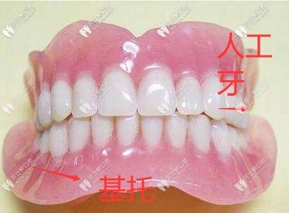 淺談全口義齒種類大全,看完就知道假牙用什么材料好了