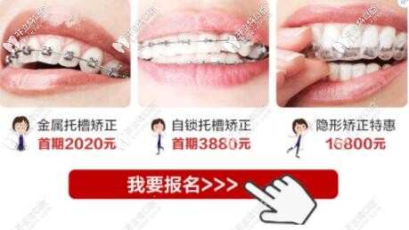 惠州致美口腔學生牙齒矯正優(yōu)惠 惠州致美口腔學生牙齒矯正優(yōu)惠