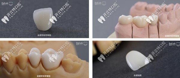 戴立克全瓷牙多少錢一顆