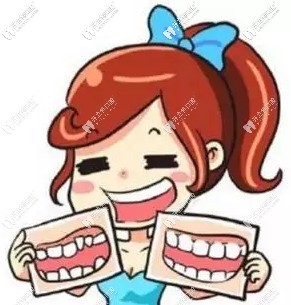 牙齒矯正前后對比圖