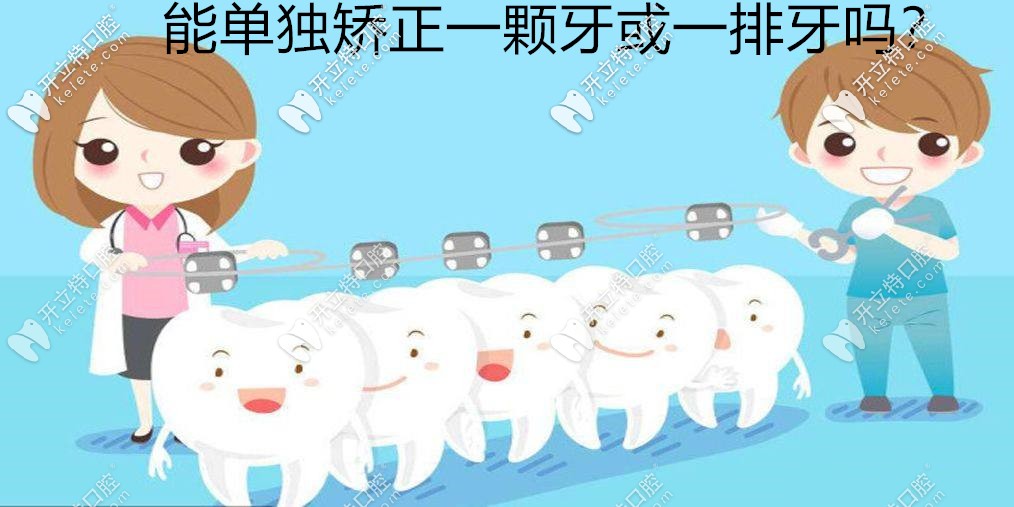 ?牙齒矯正能單獨矯正一顆歪牙或進(jìn)行一排牙齒正畸嗎？