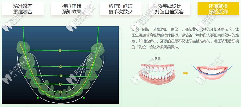 格倫菲爾口腔矯正五大優(yōu)勢