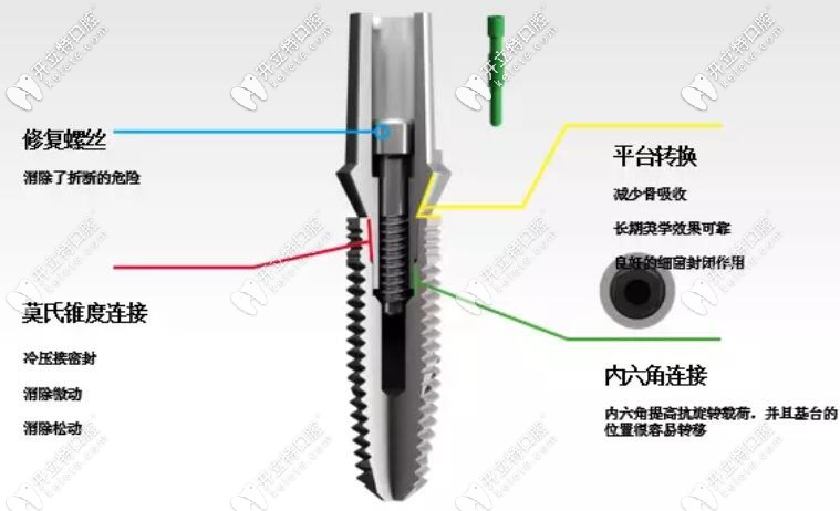 意大利bb種植體CONEXA連接技術(shù)