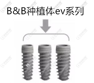 意大利bb種植體ev系列