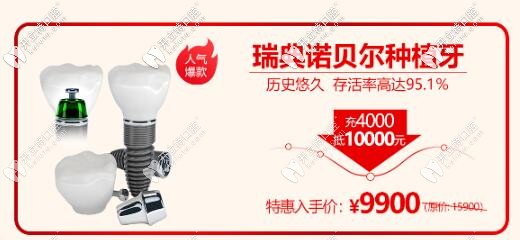 西安諾貝爾齒科瑞典諾貝爾種植體活動(dòng)價(jià)格