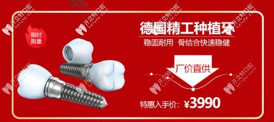 西安諾貝爾齒科德國種植牙活動(dòng)價(jià)格