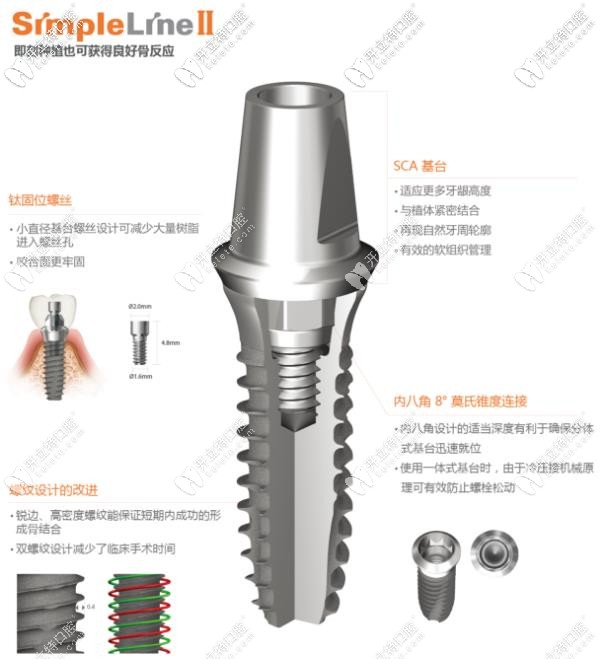 登騰simpleLineⅡ種植體型號(hào)
