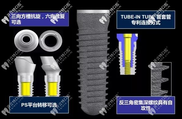 德國(guó)camlog種植牙的壽命