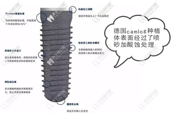 德國(guó)camlog種植體的質(zhì)量如何