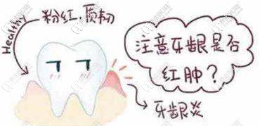 矯正時要注意牙齦是否紅腫