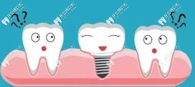種植牙