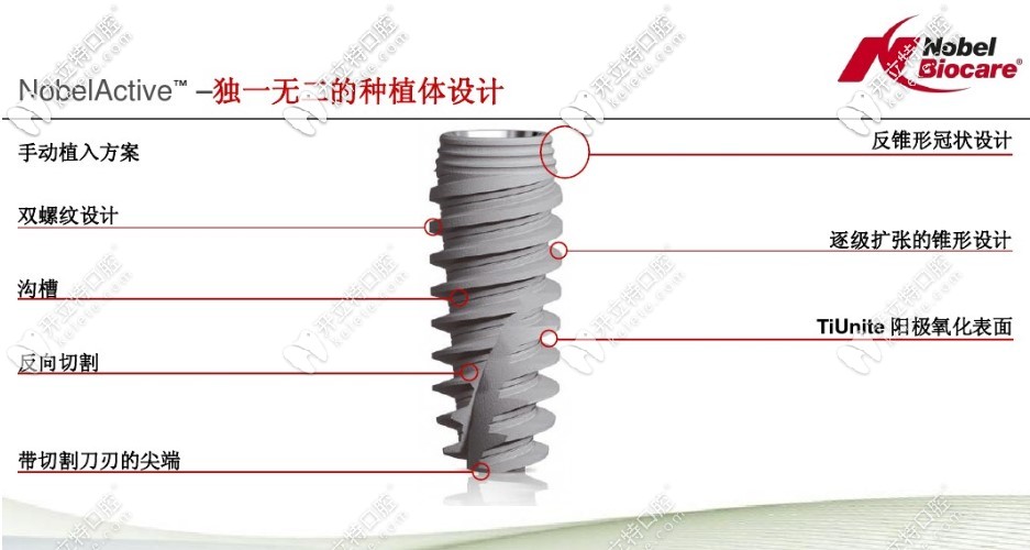nobelactive種植體的優(yōu)勢(shì)