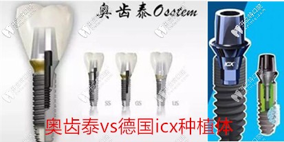 品質(zhì)vs價格,看看德國ICX和韓國奧齒泰種植體到底選擇哪個好