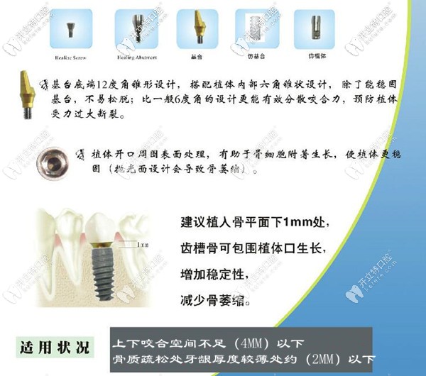 美國歐妮泰種植牙品牌適應(yīng)癥