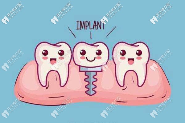 牙齒缺失的辦法之一就是種植牙