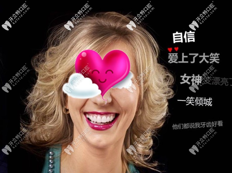 經(jīng)過DSD微笑設計后做的瓷貼面后