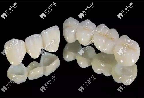 全瓷牙修復(fù) 全瓷牙修復(fù)