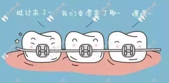 重度骨性牙齒畸形要做正畸正頜聯(lián)合治療